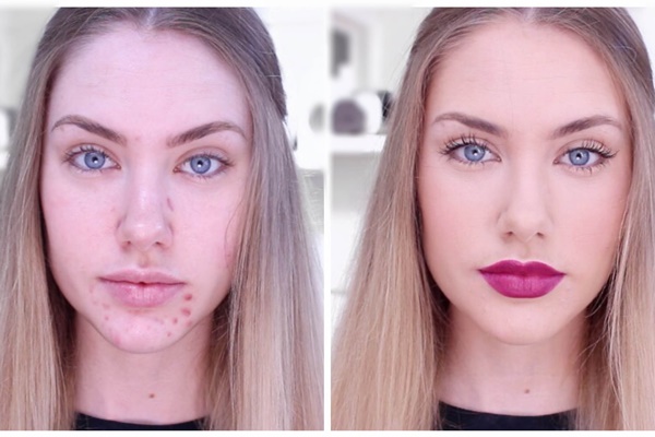 Consejos de maquillaje si tienes acné